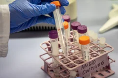 Investigadores trabajan en el desarrollo de una terapia génica para prevenir el alzhéimer