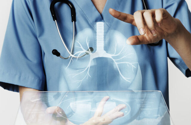 Pruebas genéticas modifican el tratamiento de pacientes con fibrosis pulmonar