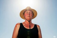 Vitamina D: este es el tiempo de sol que necesita el cuerpo sin poner en riesgo la piel