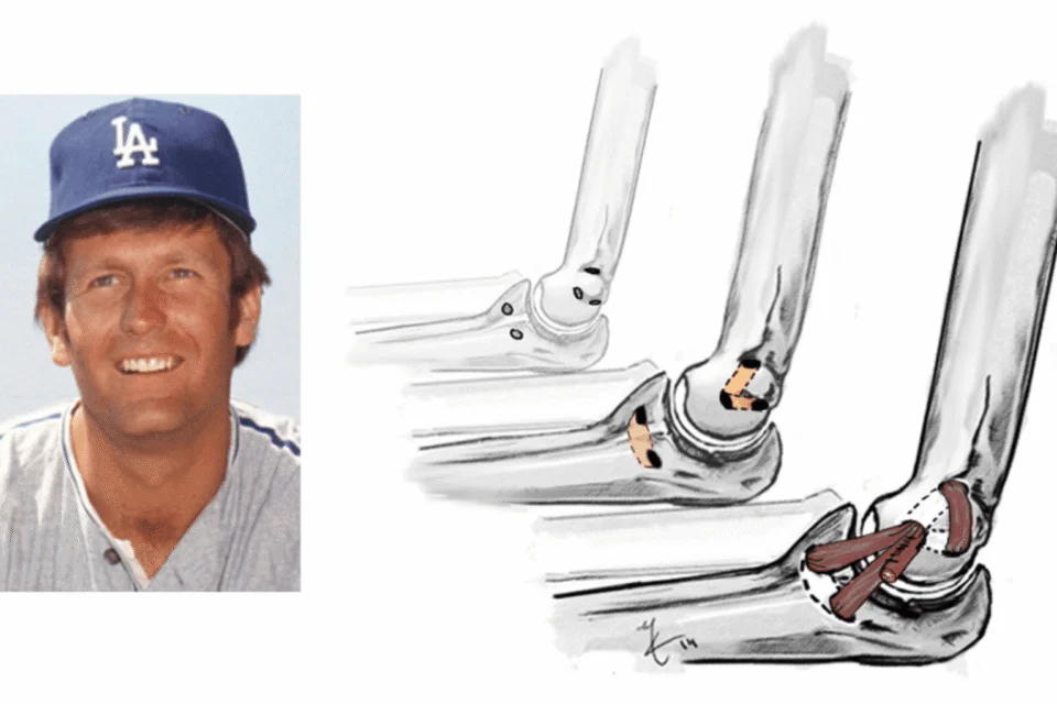 Muere a los 83 años Tommy John, exlanzador de los Dodgers y pionero de cirugía de codo